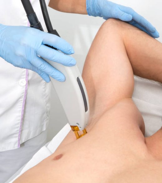 Demela-Depialcion-Medica-Laser-Demela-Valencia-446A6024-1024x683